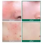 Some By Mi - Aha, Bha, Pha 30 Days Miracle Serum - Image 4