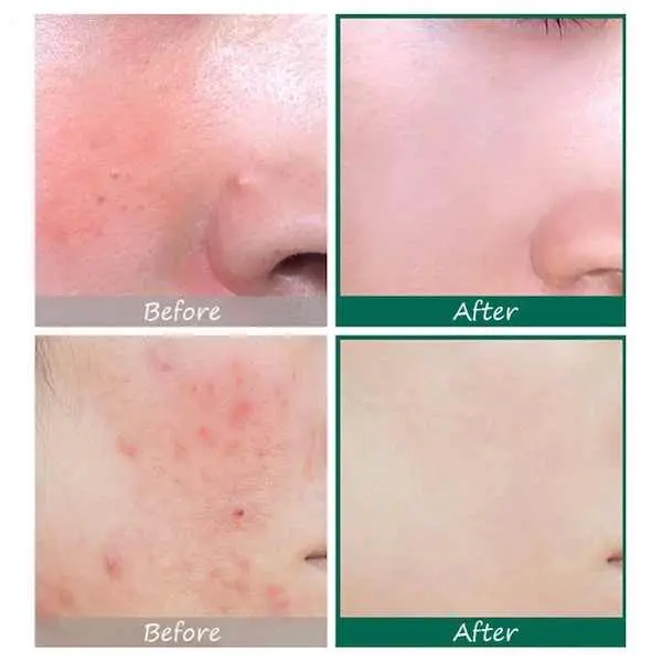 Some By Mi - Aha, Bha, Pha 30 Days Miracle Serum - Image 4