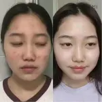 Some By Mi - Aha, Bha, Pha 30 Days Miracle Serum - Image 3