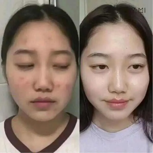 Some By Mi - Aha, Bha, Pha 30 Days Miracle Serum - Image 3