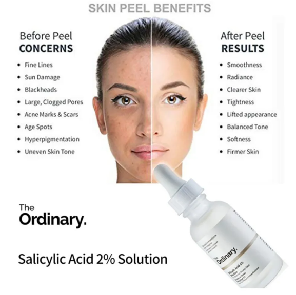 The Ordinary Salicylic Acid 2% Solution 30ml - Image 3