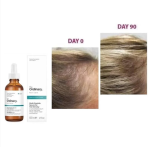 The Ordinary Multi-Peptide Serum for Hair Density 60ml BEST hair serum - Image 3