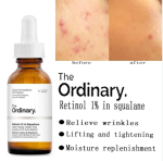The Ordinary Retinol 1% in Squalane 30ml - Image 3